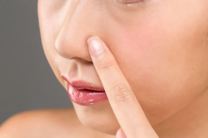 ニンニク鼻の原因