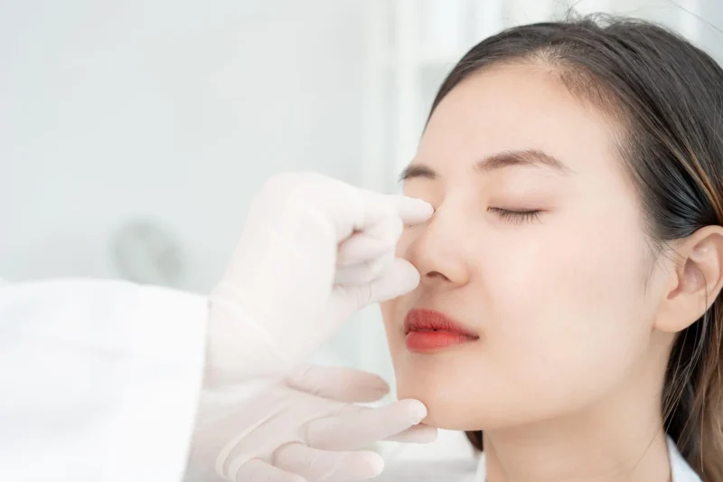 バレにくい鼻整形