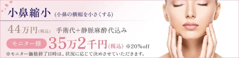 小鼻縮小(小鼻の横幅を小さくする) 44万円(税込) 手術代+静脈麻酔代込み モニター様:35万2千円(税込) ※20%off