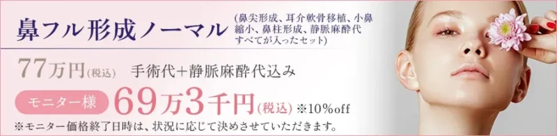 鼻フル形成ノーマル(鼻尖形成、耳介軟骨移植、小鼻縮小、鼻柱形成、静脈麻酔代すべてが入ったセット) 77万円(税込) 手術代+静脈麻酔代込み モニター様:69万3千円(税込) ※10%off