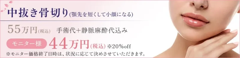 中抜き骨切り(顎先を短くして小顔になる) 55万円(税込)　手術代＋静脈麻酔代込み モニター様：44万円(税込)　※20％off