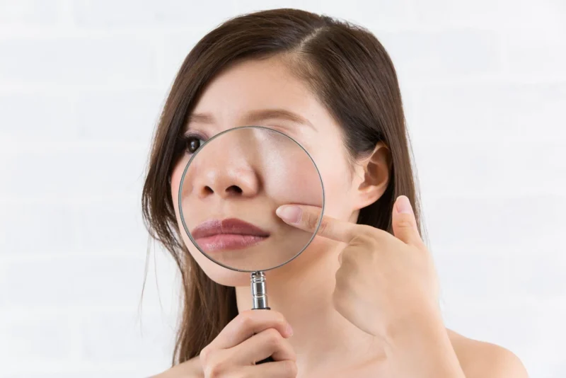 小鼻縮小だけで変になってしまう原因