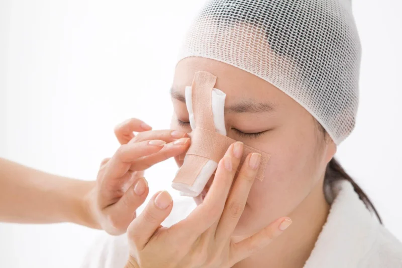 小鼻縮小との併用でバランスが整いやすい施術