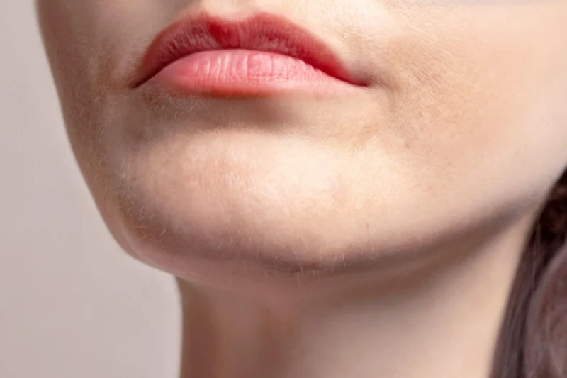 オトガイ減量術の種類